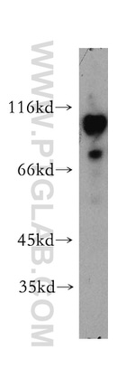 iASPP Antibody in Western Blot (WB)