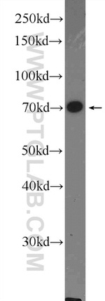 FOXO1 Antibody in Western Blot (WB)