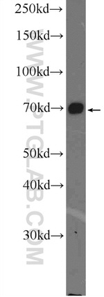 FOXO1 Antibody in Western Blot (WB)