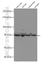 FOXO1 Antibody in Western Blot (WB)