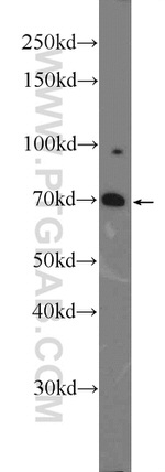 FOXO1 Antibody in Western Blot (WB)