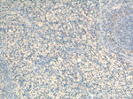 NR5A1 Antibody in Immunohistochemistry (Paraffin) (IHC (P))