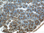 NR5A1 Antibody in Immunohistochemistry (Paraffin) (IHC (P))