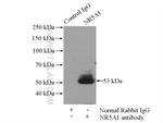NR5A1 Antibody in Immunoprecipitation (IP)