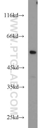 NR5A1 Antibody in Western Blot (WB)