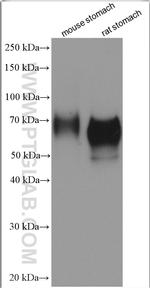 ATP4B Antibody in Western Blot (WB)