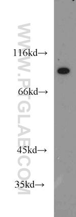 ATP4B Antibody in Western Blot (WB)