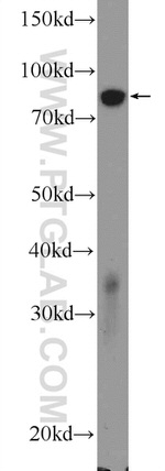 ATP4B Antibody in Western Blot (WB)