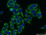 LSS Antibody in Immunocytochemistry (ICC/IF)