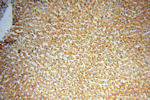 LSS Antibody in Immunohistochemistry (Paraffin) (IHC (P))