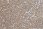 LSS Antibody in Immunohistochemistry (Paraffin) (IHC (P))