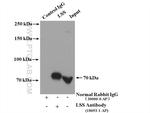 LSS Antibody in Immunoprecipitation (IP)