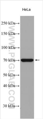 LSS Antibody in Western Blot (WB)