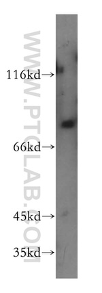 LSS Antibody in Western Blot (WB)