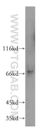 LSS Antibody in Western Blot (WB)