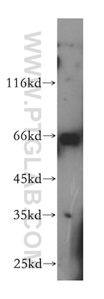 LSS Antibody in Western Blot (WB)