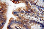 BRK Antibody in Immunohistochemistry (Paraffin) (IHC (P))