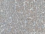 EPHA1 Antibody in Immunohistochemistry (Paraffin) (IHC (P))