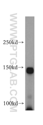 EPHA1 Antibody in Western Blot (WB)