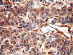 EPHA1 Antibody in Immunohistochemistry (Paraffin) (IHC (P))