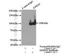 EPHA1 Antibody in Immunoprecipitation (IP)