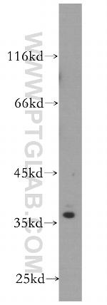 SRA1 Antibody in Western Blot (WB)