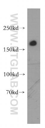 CD206 Antibody in Western Blot (WB)