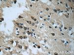 RIC8A Antibody in Immunohistochemistry (Paraffin) (IHC (P))