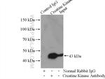 CKM Antibody in Immunoprecipitation (IP)