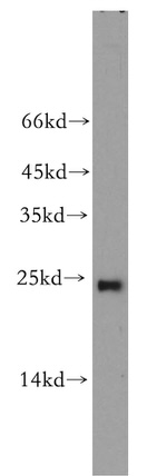 RAB9A Antibody in Western Blot (WB)