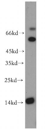 LC3A Antibody in Western Blot (WB)