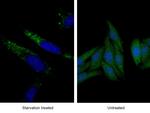 GABARAP Antibody in Immunocytochemistry (ICC/IF)