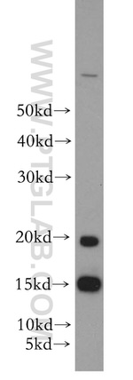 GABARAP Antibody in Western Blot (WB)