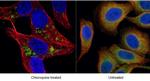 LC3B Antibody in Immunocytochemistry (ICC/IF)