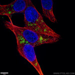 LC3B Antibody in Immunocytochemistry (ICC/IF)