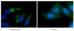 LC3B Antibody in Immunocytochemistry (ICC/IF)