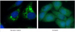 LC3B Antibody in Immunocytochemistry (ICC/IF)