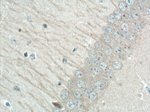 LC3B Antibody in Immunohistochemistry (Paraffin) (IHC (P))