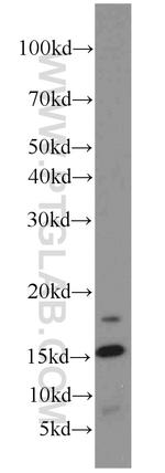 LC3B Antibody in Western Blot (WB)