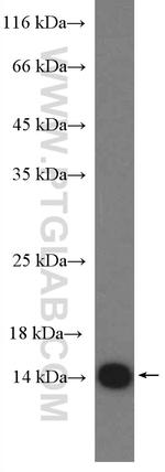 LC3B Antibody in Western Blot (WB)