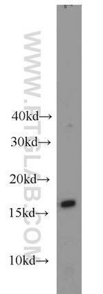 LC3B Antibody in Western Blot (WB)