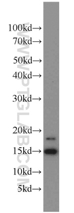 LC3B Antibody in Western Blot (WB)