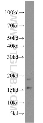 LC3B Antibody in Western Blot (WB)