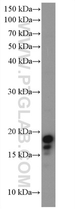 LC3B Antibody in Western Blot (WB)