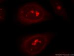 DNA2 Antibody in Immunocytochemistry (ICC/IF)