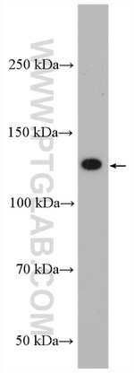 DNA2 Antibody in Western Blot (WB)