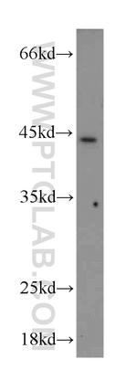 HOXB1 Antibody in Western Blot (WB)