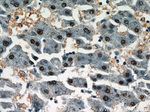 HOXD13 Antibody in Immunohistochemistry (Paraffin) (IHC (P))