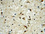 HOXD13 Antibody in Immunohistochemistry (Paraffin) (IHC (P))