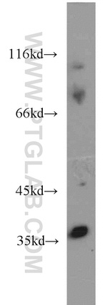 HOXD13 Antibody in Western Blot (WB)